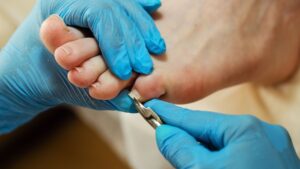 At-Home Foot Care Vancouver