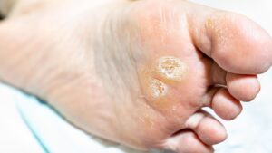 In-Home Pedicure Vancouver